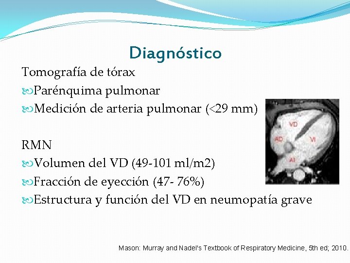 Diagnóstico Tomografía de tórax Parénquima pulmonar Medición de arteria pulmonar (<29 mm) RMN Volumen Diagnóstico Tomografía de tórax Parénquima pulmonar Medición de arteria pulmonar (<29 mm) RMN Volumen