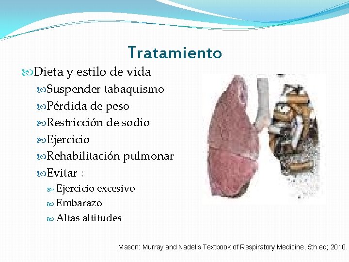 Tratamiento Dieta y estilo de vida Suspender tabaquismo Pérdida de peso Restricción de sodio Tratamiento Dieta y estilo de vida Suspender tabaquismo Pérdida de peso Restricción de sodio