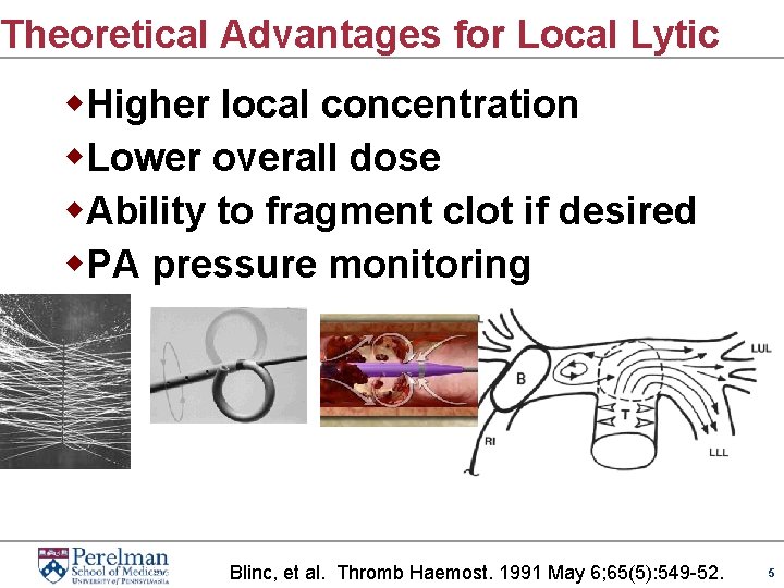 Theoretical Advantages for Local Lytic w. Higher local concentration w. Lower overall dose w.