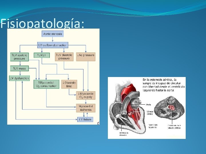 Fisiopatología: 