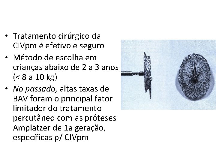  • Tratamento cirúrgico da CIVpm é efetivo e seguro • Método de escolha