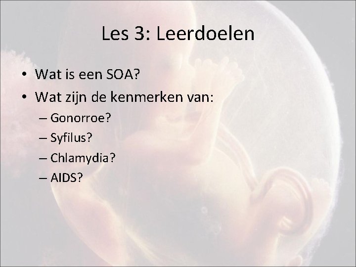 Les 3: Leerdoelen • Wat is een SOA? • Wat zijn de kenmerken van: