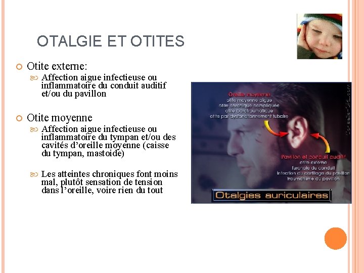 OTALGIE ET OTITES Otite externe: Affection aigue infectieuse ou inflammatoire du conduit auditif et/ou