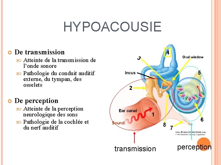 HYPOACOUSIE De transmission Atteinte de la transmission de l’onde sonore Pathologie du conduit auditif