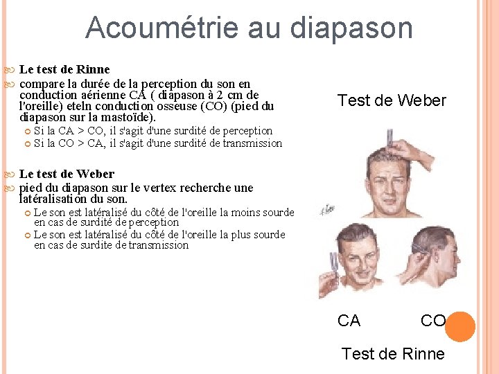 Acoumétrie au diapason Le test de Rinne compare la durée de la perception du