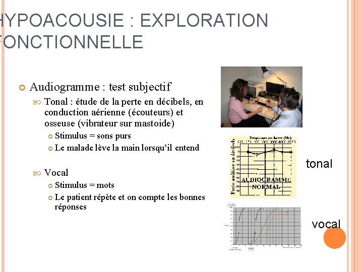 HYPOACOUSIE : EXPLORATION FONCTIONNELLE Audiogramme : test subjectif Tonal : étude de la perte