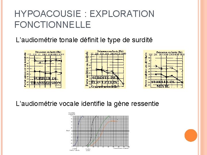 HYPOACOUSIE : EXPLORATION FONCTIONNELLE L’audiométrie tonale définit le type de surdité L’audiométrie vocale identifie