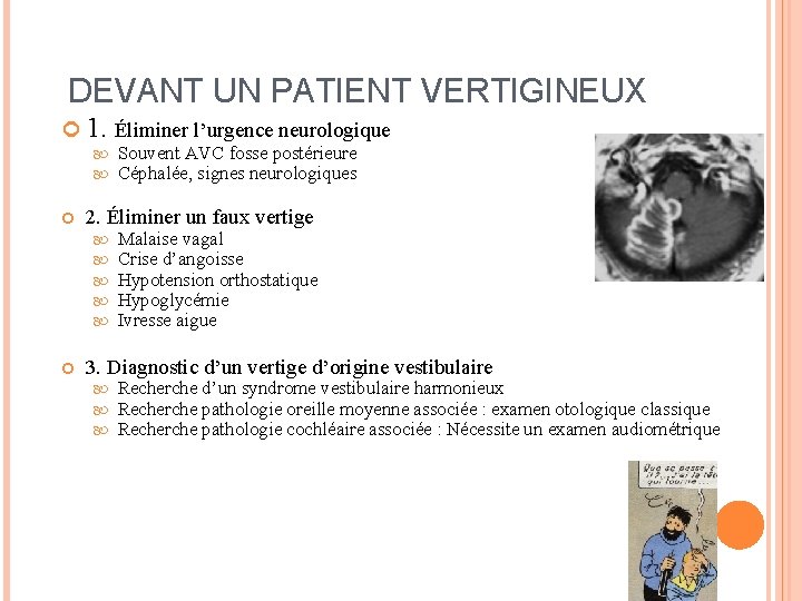 DEVANT UN PATIENT VERTIGINEUX 1. Éliminer l’urgence neurologique 2. Éliminer un faux vertige Souvent