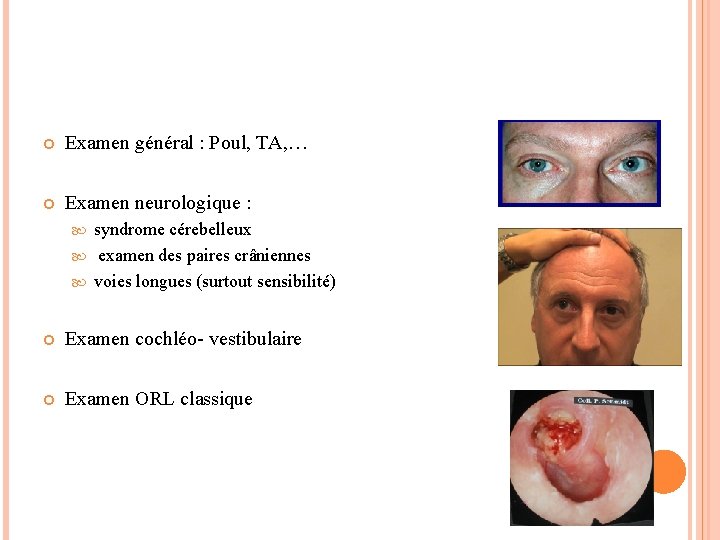 EXAMEN DU VERTIGINEUX Examen général : Poul, TA, … Examen neurologique : syndrome cérebelleux