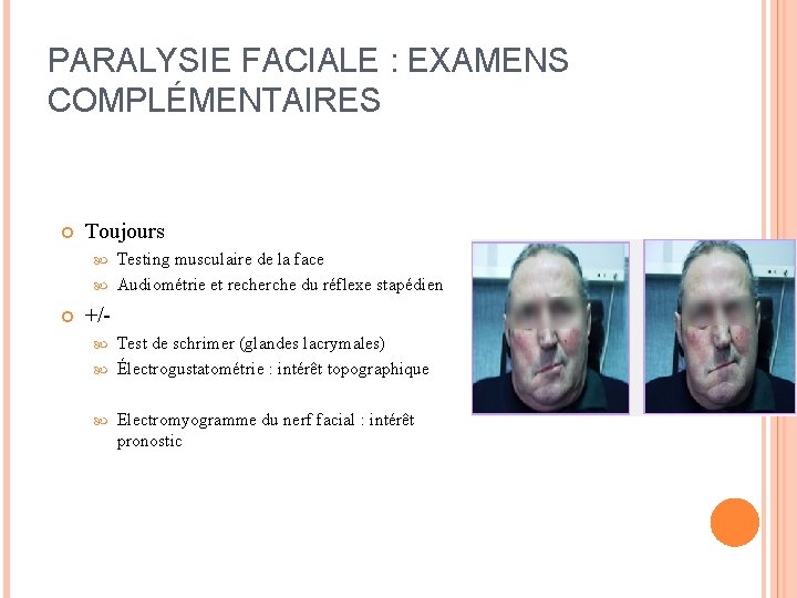 PARALYSIE FACIALE : EXAMENS COMPLÉMENTAIRES Toujours Testing musculaire de la face Audiométrie et recherche