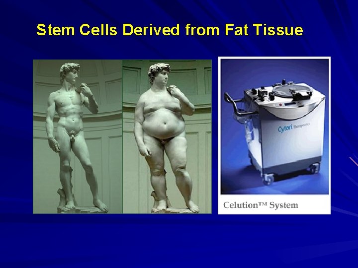 Stem Cells Derived from Fat Tissue 