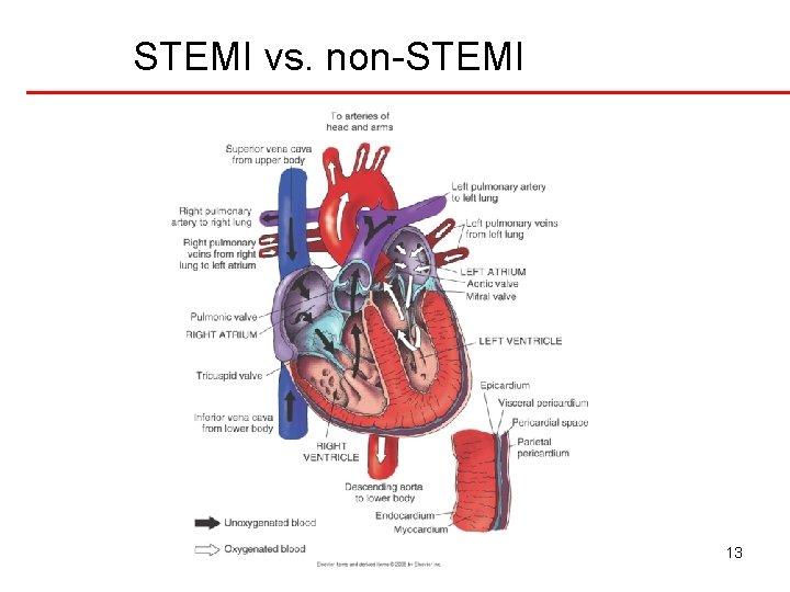 STEMI vs. non-STEMI 13 