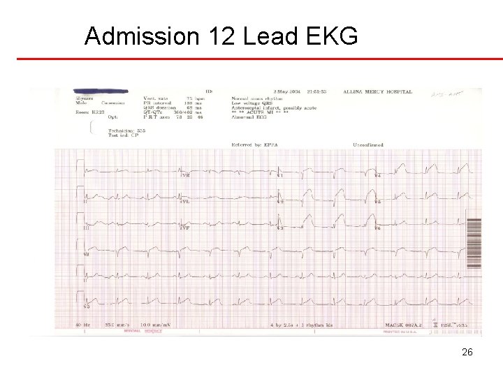 Admission 12 Lead EKG 26 