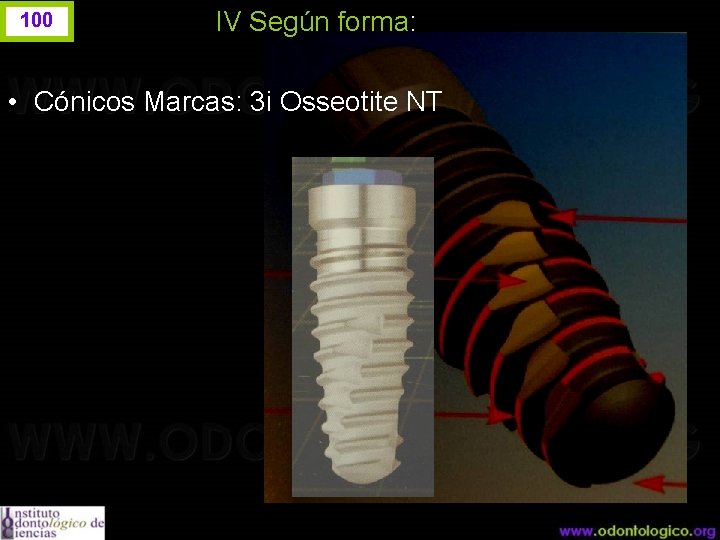 100 IV Según forma: • Cónicos Marcas: 3 i Osseotite NT 