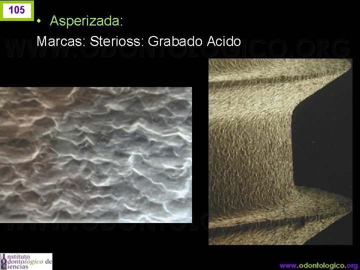 105 • Asperizada: Marcas: Sterioss: Grabado Acido 