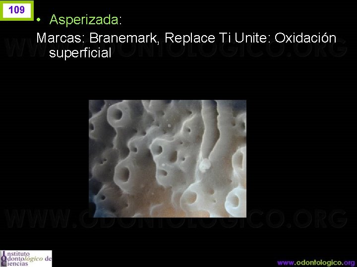 109 • Asperizada: Marcas: Branemark, Replace Ti Unite: Oxidación superficial 