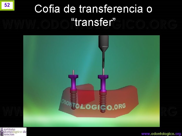 52 J. I. H. Cofia de transferencia o “transfer” 