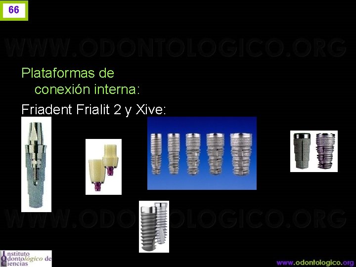 66 Plataformas de conexión interna: Friadent Frialit 2 y Xive: 