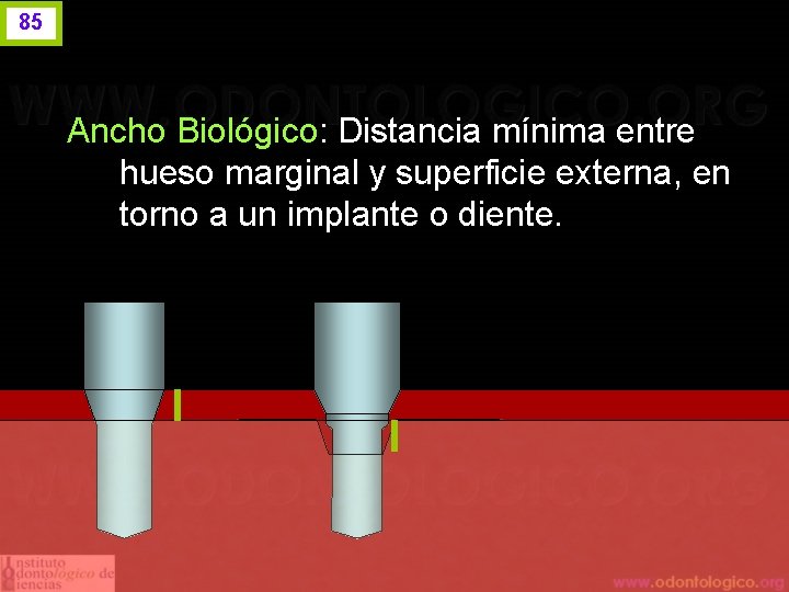 85 Ancho Biológico: Distancia mínima entre hueso marginal y superficie externa, en torno a