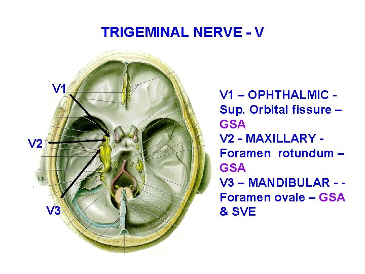 TRIGEMINAL NERVE - V V 1 V 2 V 3 V 1 – OPHTHALMIC