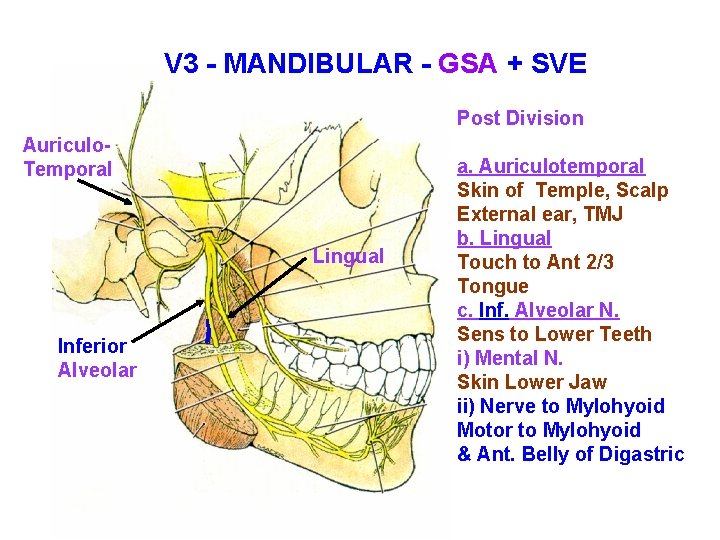 V 3 - MANDIBULAR - GSA + SVE Post Division Auriculo. Temporal Lingual Inferior