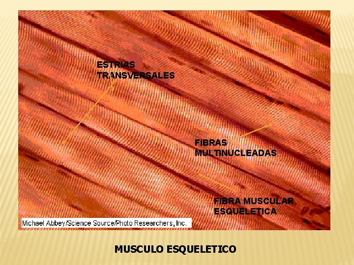 ESTRIAS TRANSVERSALES FIBRAS MULTINUCLEADAS FIBRA MUSCULAR ESQUELETICA MUSCULO ESQUELETICO 