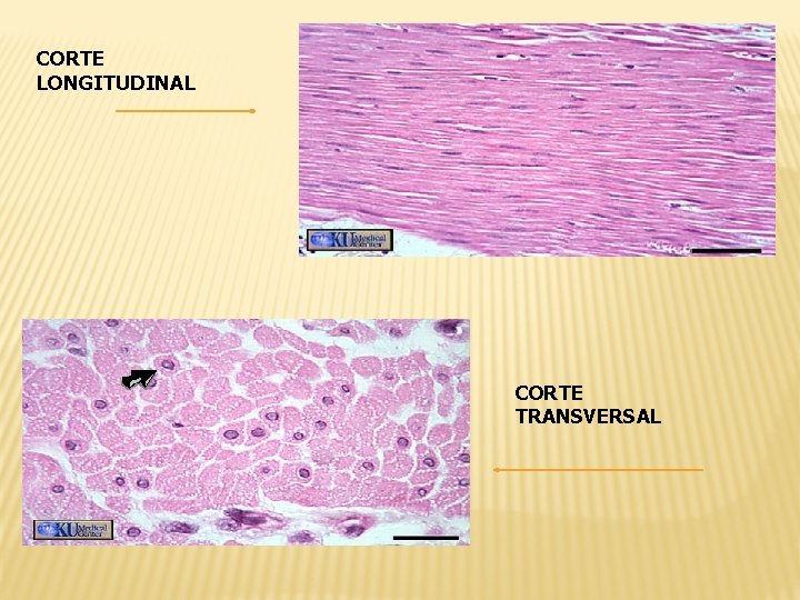 CORTE LONGITUDINAL CORTE TRANSVERSAL 