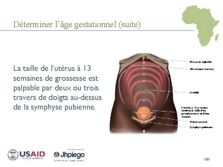 Déterminer l’âge gestationnel (suite) Processus xiphoïde La taille de l’utérus à 13 semaines de