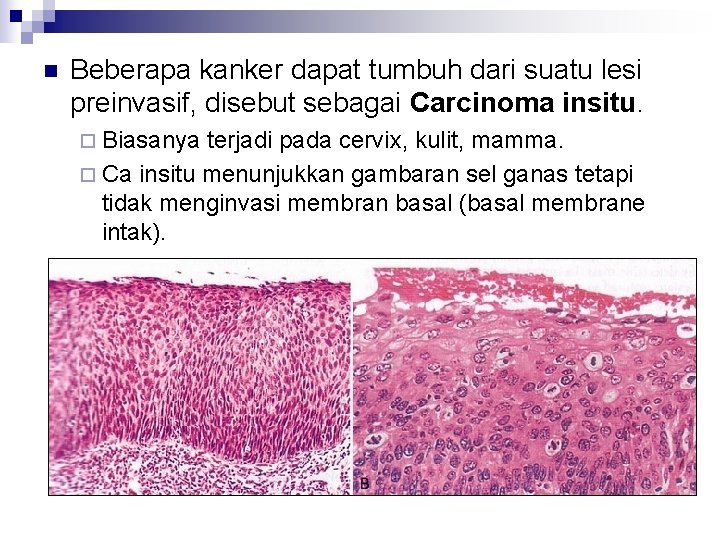 n Beberapa kanker dapat tumbuh dari suatu lesi preinvasif, disebut sebagai Carcinoma insitu. ¨