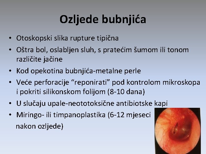 Ozljede bubnjića • Otoskopski slika rupture tipična • Oštra bol, oslabljen sluh, s pratećim Ozljede bubnjića • Otoskopski slika rupture tipična • Oštra bol, oslabljen sluh, s pratećim