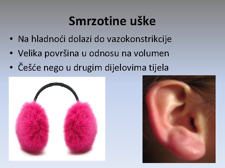 Smrzotine uške • Na hladnoći dolazi do vazokonstrikcije • Velika površina u odnosu na Smrzotine uške • Na hladnoći dolazi do vazokonstrikcije • Velika površina u odnosu na