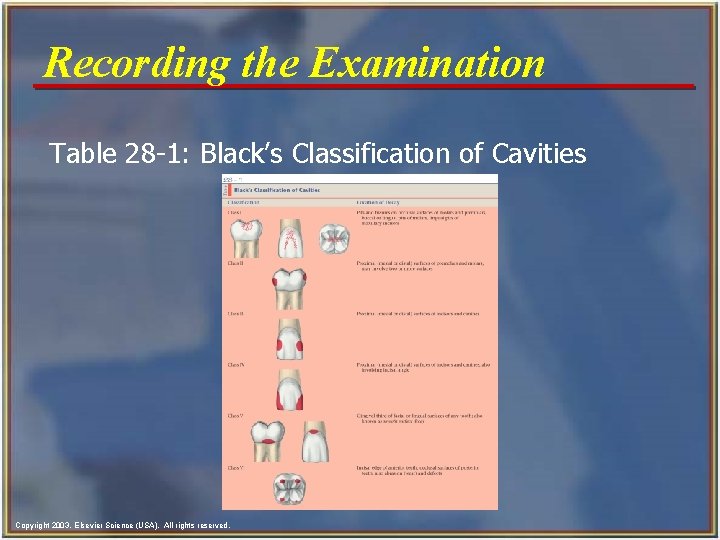 Recording the Examination Table 28 -1: Black’s Classification of Cavities Copyright 2003, Elsevier Science
