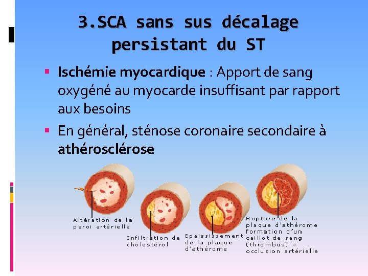 3. SCA sans sus décalage persistant du ST Ischémie myocardique : Apport de sang