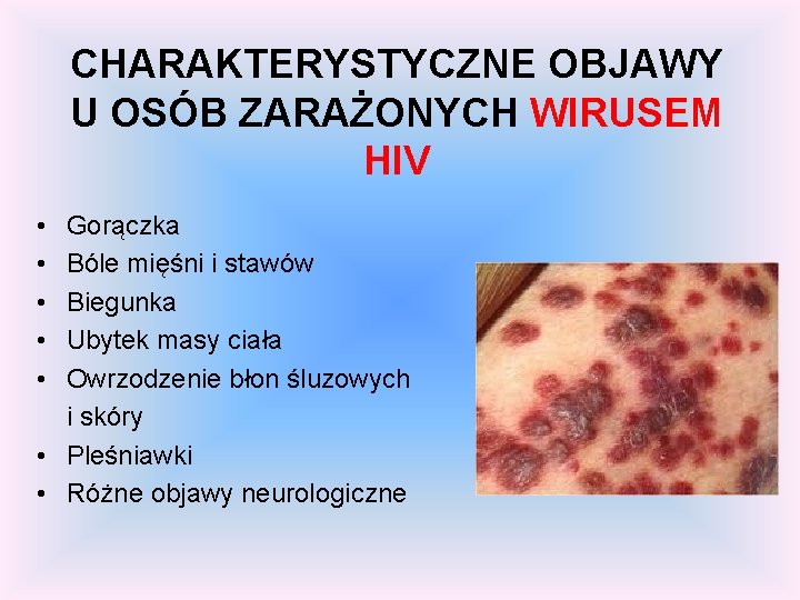 CHARAKTERYSTYCZNE OBJAWY U OSÓB ZARAŻONYCH WIRUSEM HIV • • • Gorączka Bóle mięśni i