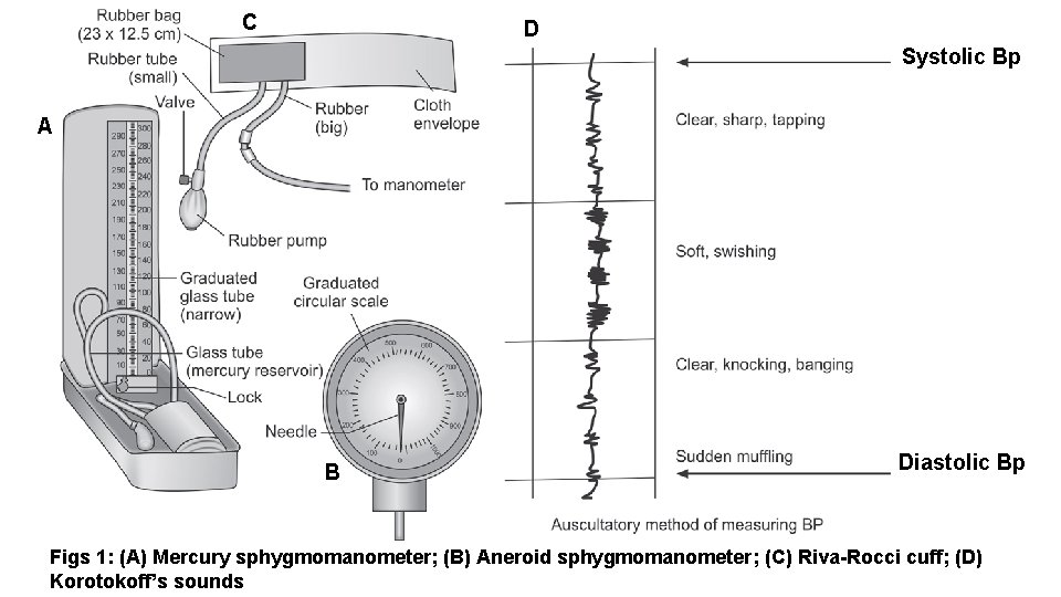 C D Systolic Bp A B Diastolic Bp Figs 1: (A) Mercury sphygmomanometer; (B)