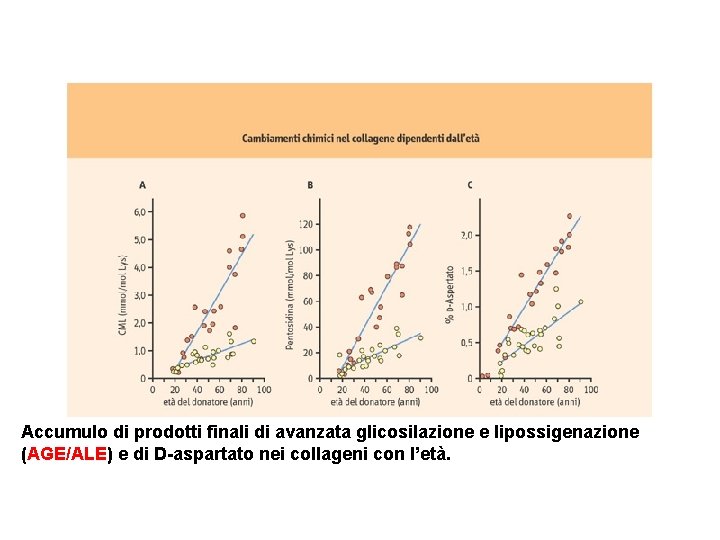 Accumulo di prodotti finali di avanzata glicosilazione e lipossigenazione (AGE/ALE) e di D-aspartato nei