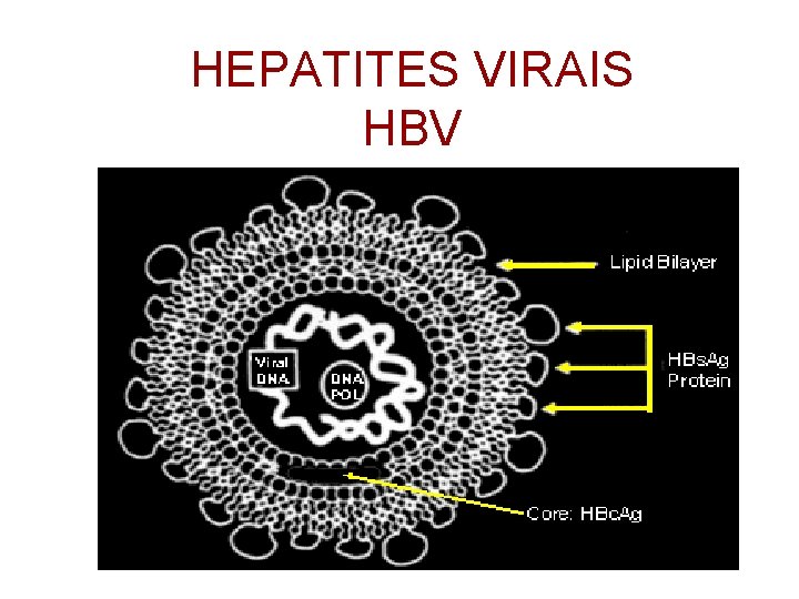 HEPATITES VIRAIS HBV 