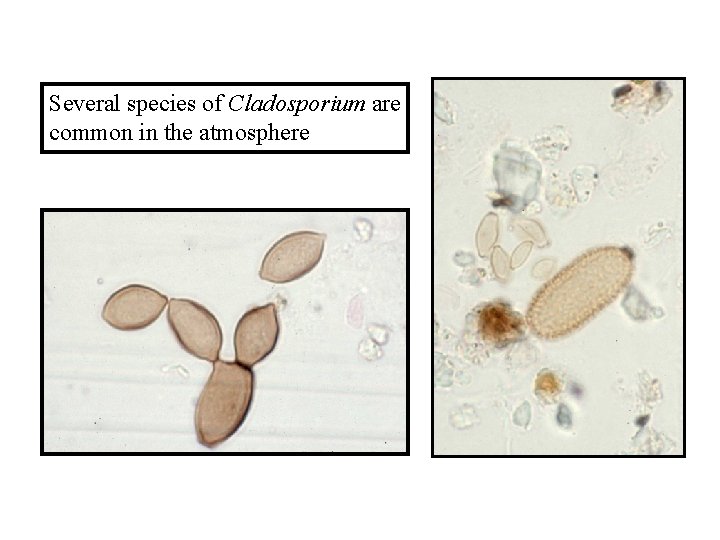 Several species of Cladosporium are common in the atmosphere 