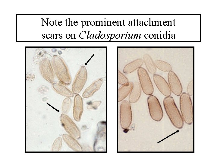 Note the prominent attachment scars on Cladosporium conidia 