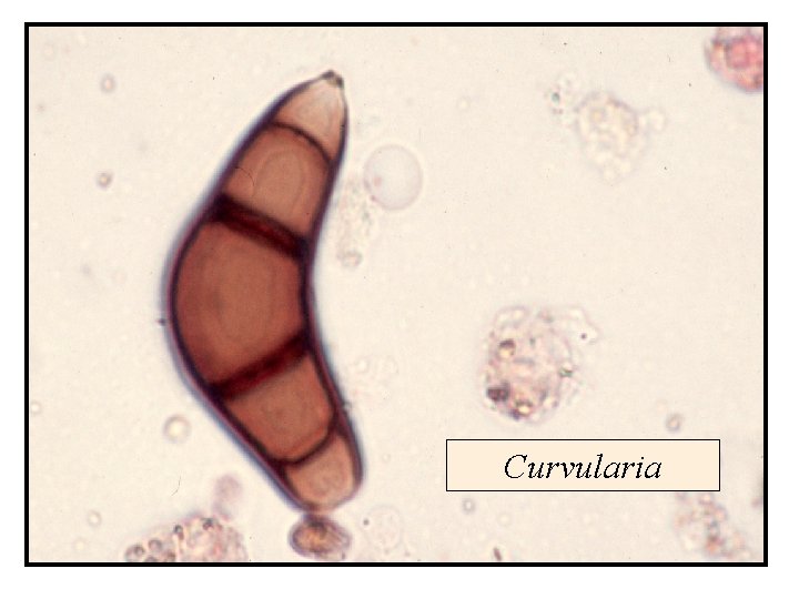 Curvularia 