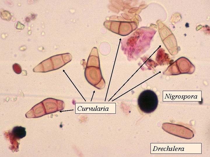 Nigrospora Curvularia Drechslera 