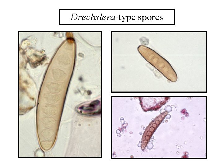 Drechslera-type spores 