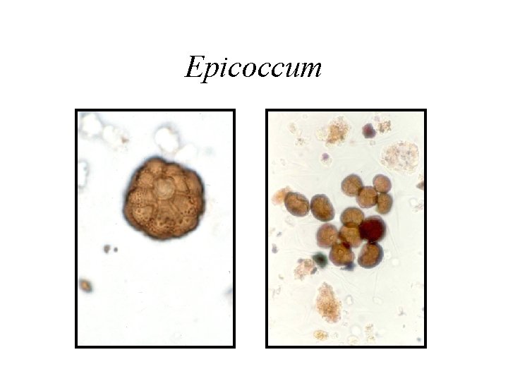 Epicoccum 