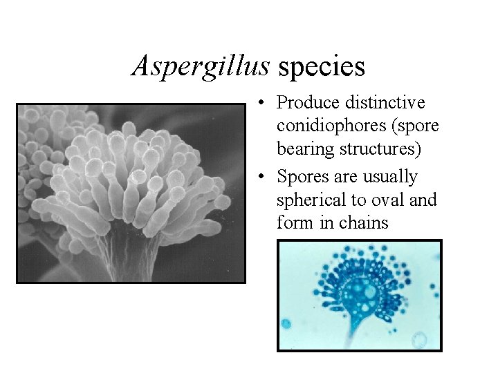 Aspergillus species • Produce distinctive conidiophores (spore bearing structures) • Spores are usually spherical