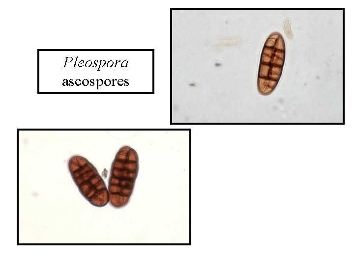 Pleospora ascospores 