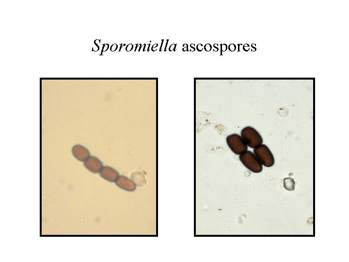 Sporomiella ascospores 