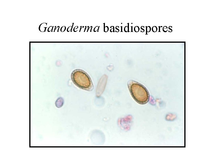Ganoderma basidiospores 