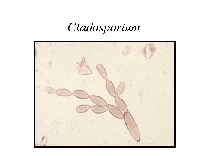 Cladosporium 