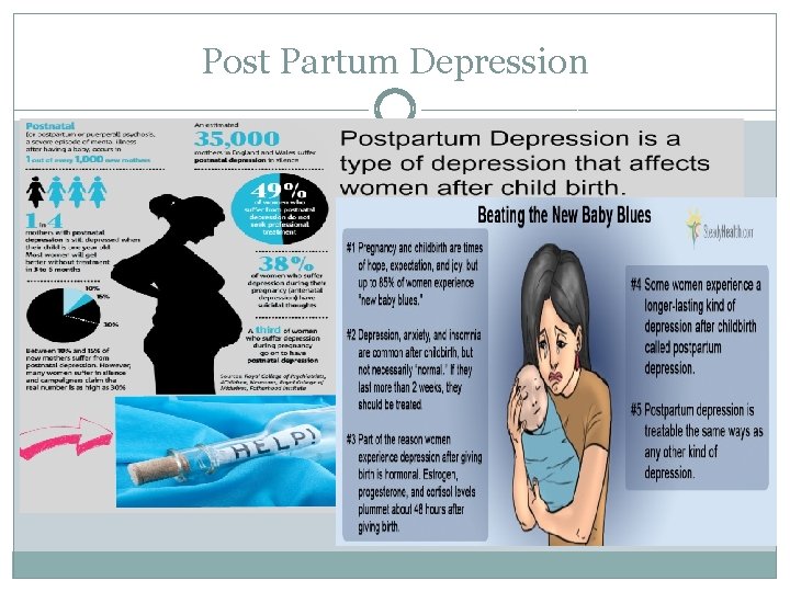 Post Partum Depression 