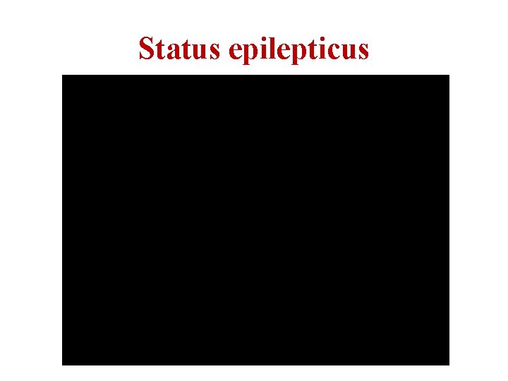 Status epilepticus 